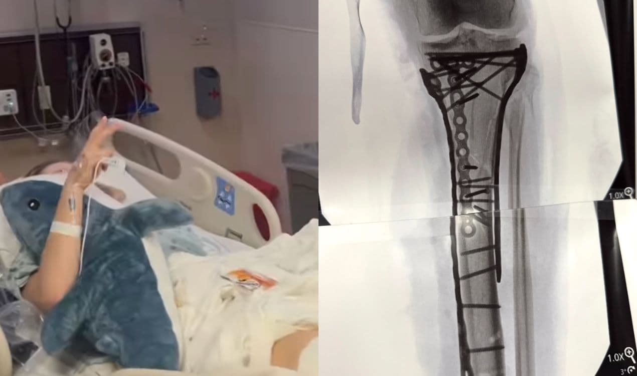 Lindsey Vonn, quinto intervento dopo Milano Cortina 2026: «Sei ore di sala operatoria»